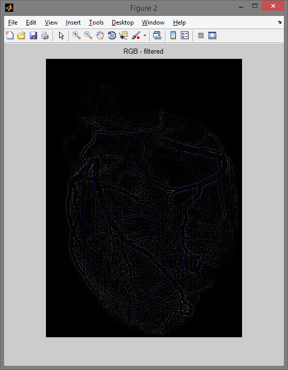 Filtr specjalny Laplacian.