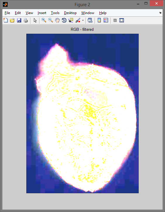 Filtr uśredniający dolnoprzepustowy.