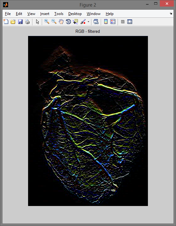 Filtr wykrywający krawędzie Sobela.