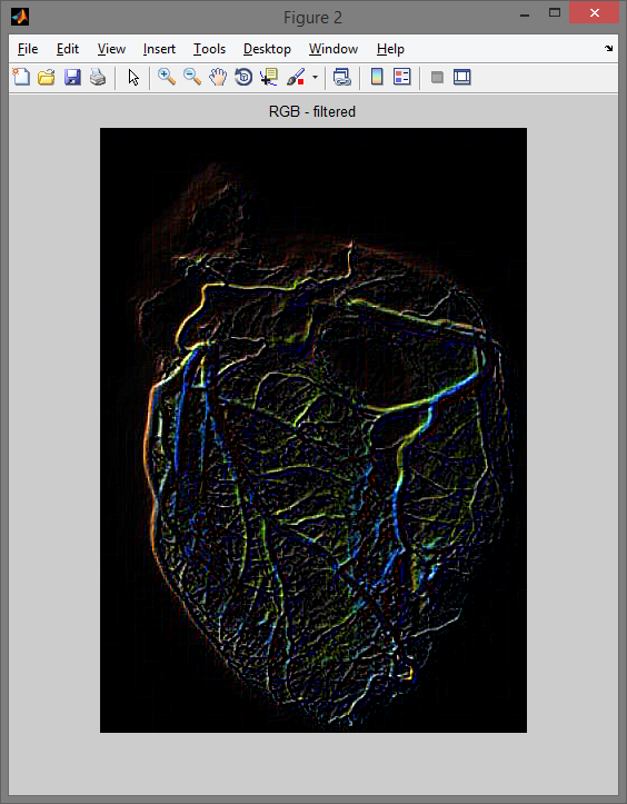 Filtr wykrywający narożniki.